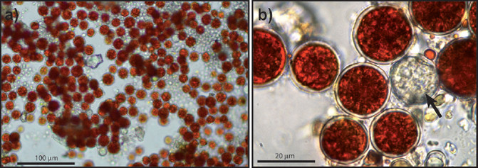 Colonia de microalgas ‘H. pluvialis’ en estadio de enquistamiento y detalle donde se aprecia el color rojo del núcleo celular por la producción de axtasantina. La flecha indica un espécimen transparente sin el carotenoide.