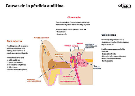 BrainHearing, la nueva tecnología que ayuda a escuchar al cerebro