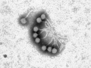 Bacteriófagos, ¿podrían ser una alternativa a los antibióticos?