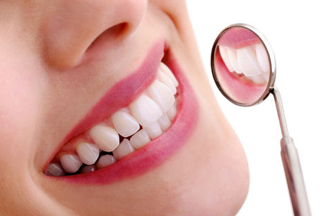 Blanqueadores dentales: ¿qué tienes que saber?