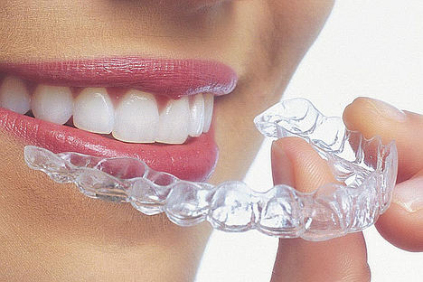 La ortodoncia invisible, una solución personalizada para la salud bucodental